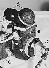 An intra ocular camera telescope developed by Ronald Plummer.